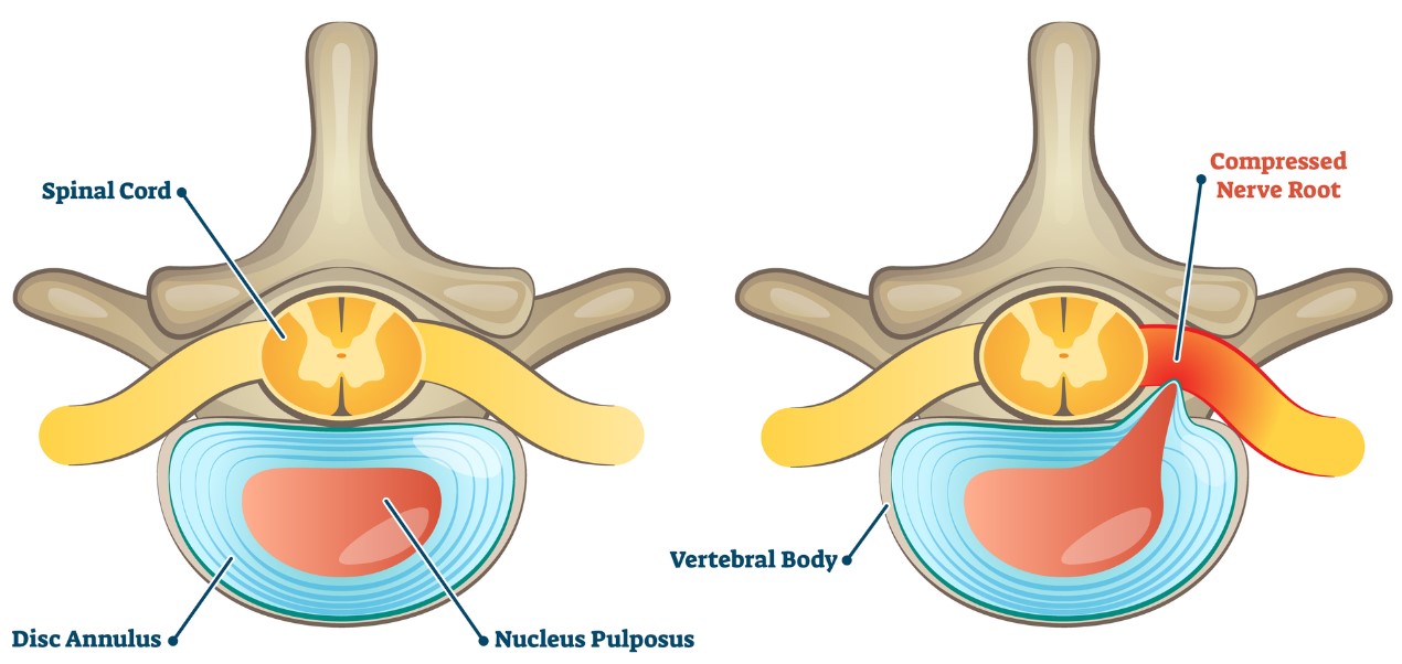 Spinal Anatomy Diagram
